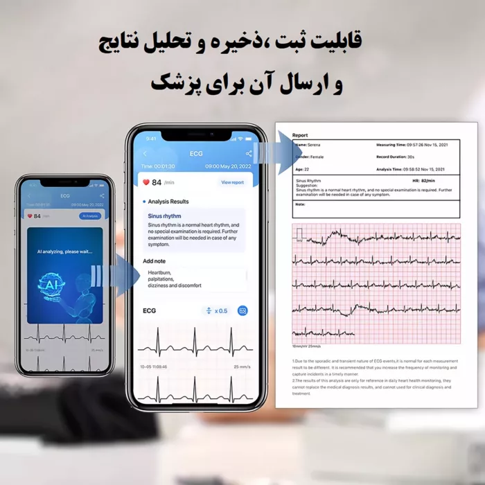 فشارسنج دیجیتال ولو مدل آرمفیت پلاس